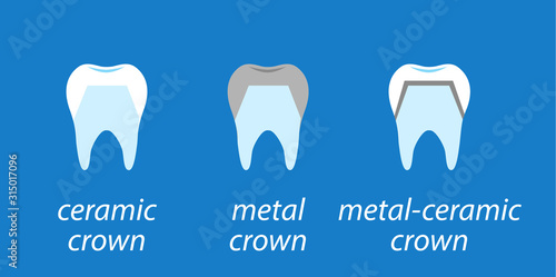 Icons dental on blue background. Service installation of a ceramic crown. As well as a metal and gold crown on the tooth. Set icons flat style.