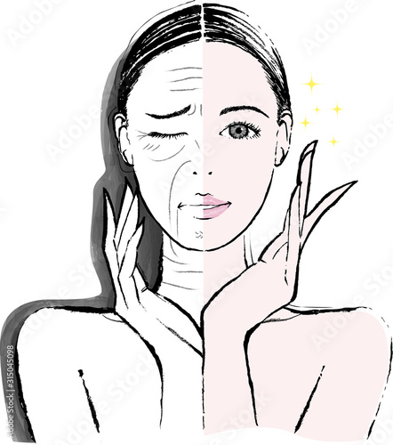 女性　シワ　ビフォーアフター
