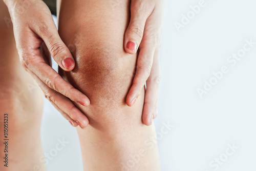 фотографія woman having problem with dark and wrinkle skin on knee
