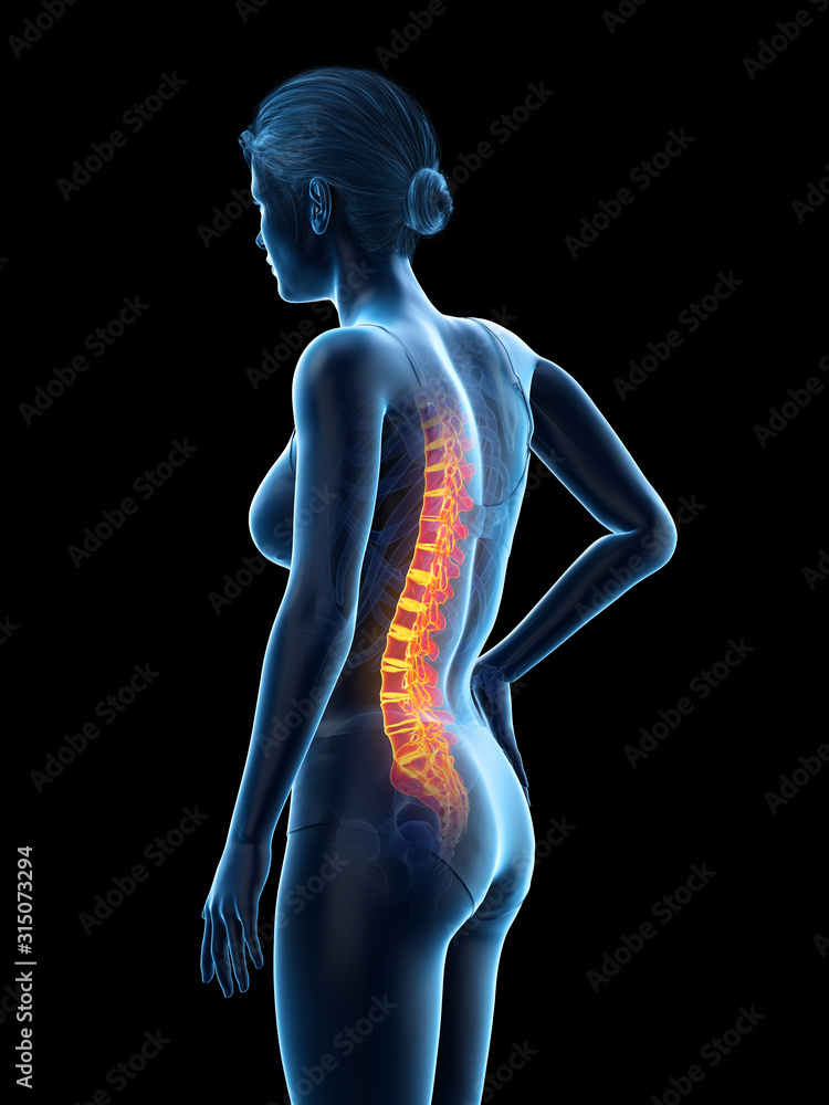 3d rendered medically accurate illustration of a woman having a painful back 3d rendered medically accurate illustration of a woman having a painful back