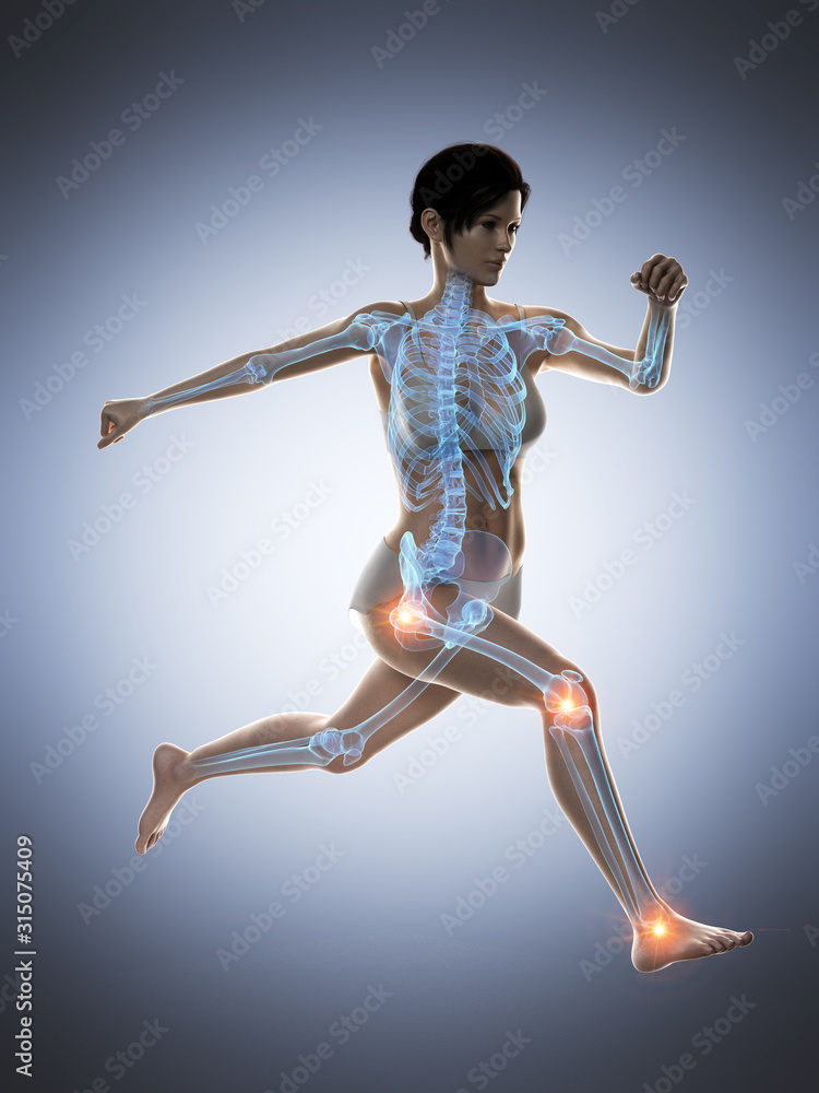 3d rendered medically accurate illustration of a woman having painful joints while running