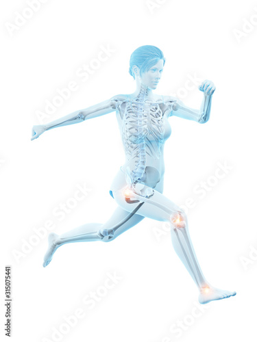 3d rendered medically accurate illustration of a woman having painful joints while running