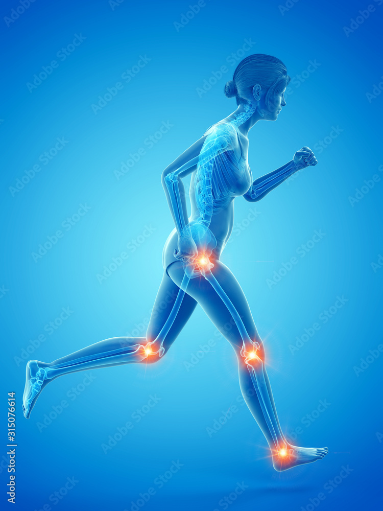 3d rendered medically accurate illustration of a woman having painful joints while running 3d rendered medically accurate illustration of a woman having painful joints while running
