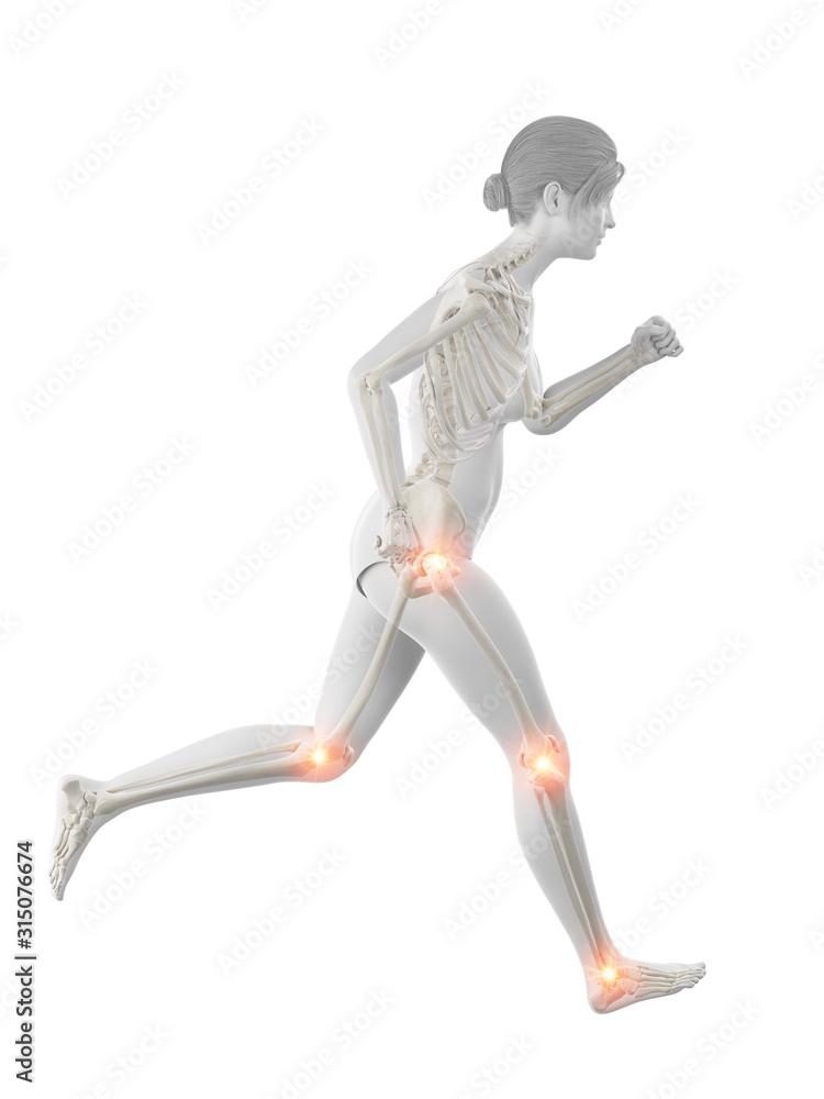 3d rendered medically accurate illustration of a woman having painful joints while running 3d rendered medically accurate illustration of a woman having painful joints while running
