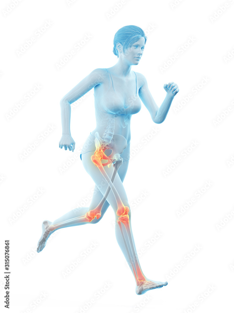3d rendered medically accurate illustration of a woman having painful joints while running 3d rendered medically accurate illustration of a woman having painful joints while running