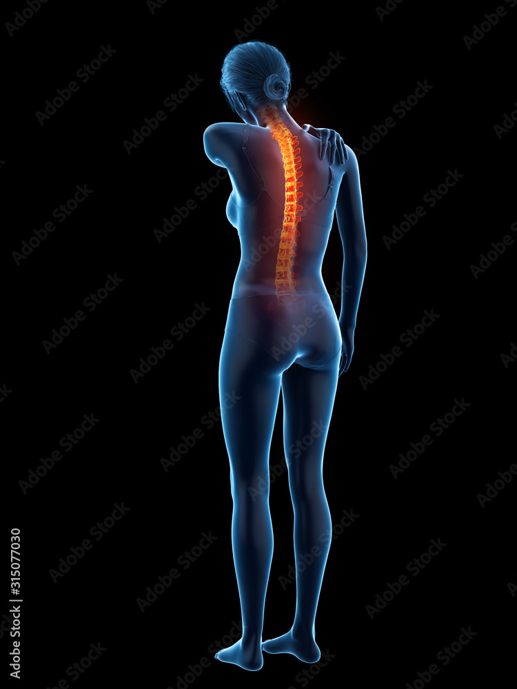 3d rendered medically accurate illustration of a woman having a backache 3d rendered medically accurate illustration of a woman having a backache