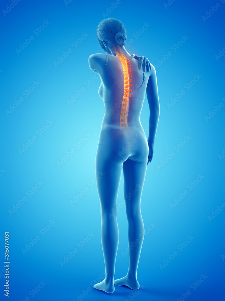 3d rendered medically accurate illustration of a woman having a backache 3d rendered medically accurate illustration of a woman having a backache