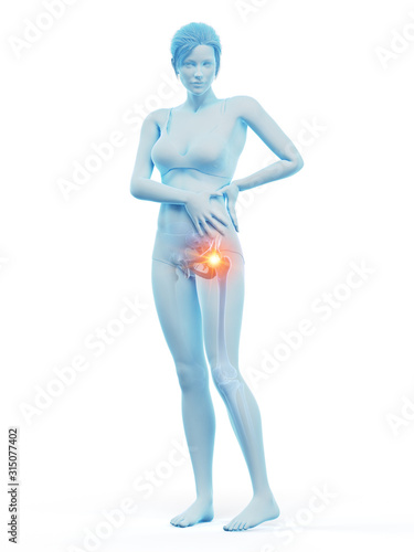 3d rendered medically accurate illustration of a woman having a painful hip