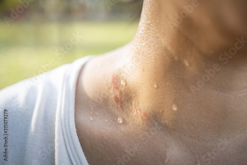 Closeup of wet female throat with water drops or sweat on skin,symptom of panic disorder, lymphoma or obesity, Sweaty asian woman after gym workout or hot weather,sweating, hyperhidrosis concept