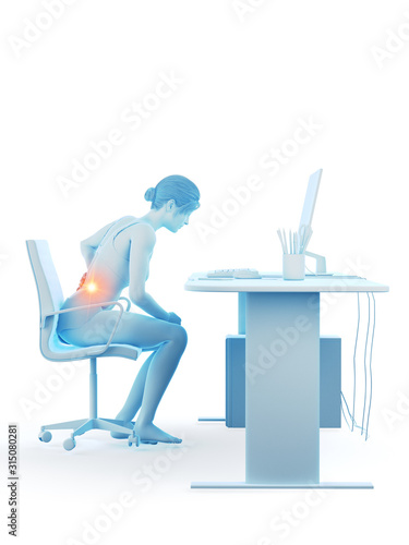 3d rendered medically accurate illustration of a woman having a painful back while working © Sebastian Kaulitzki