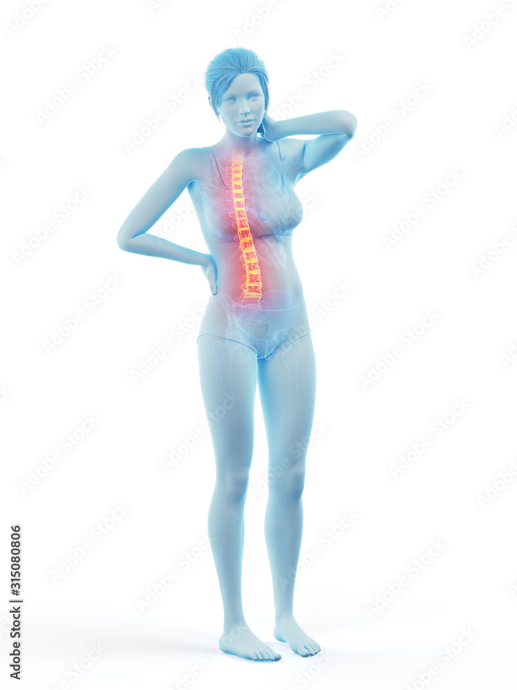 3d rendered medically accurate illustration of a woman having a backache 3d rendered medically accurate illustration of a woman having a backache
