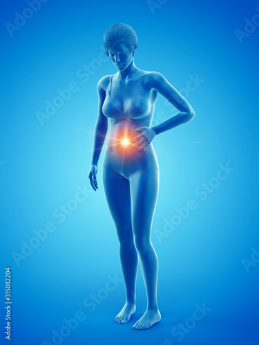 3d rendered medically accurate illustration of a woman having a bellyache © Sebastian Kaulitzki