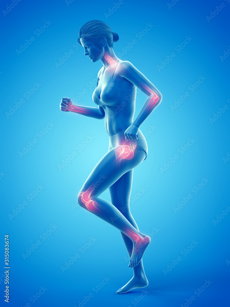 3d rendered medically accurate illustration of a woman having painful joints while walking