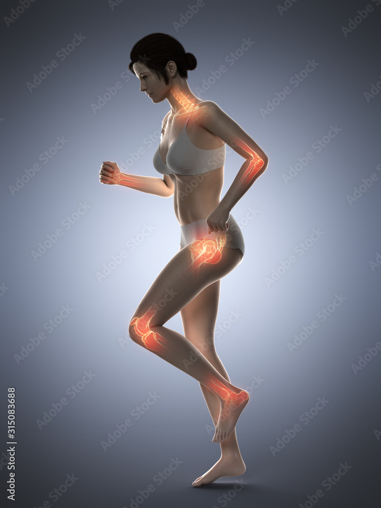 3d rendered medically accurate illustration of a woman having painful joints while walking
