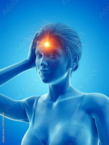 3d rendered medically accurate illustration of a woman having a headache