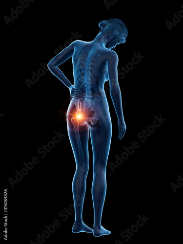 3d rendered medically accurate illustration of a woman having a painful hip