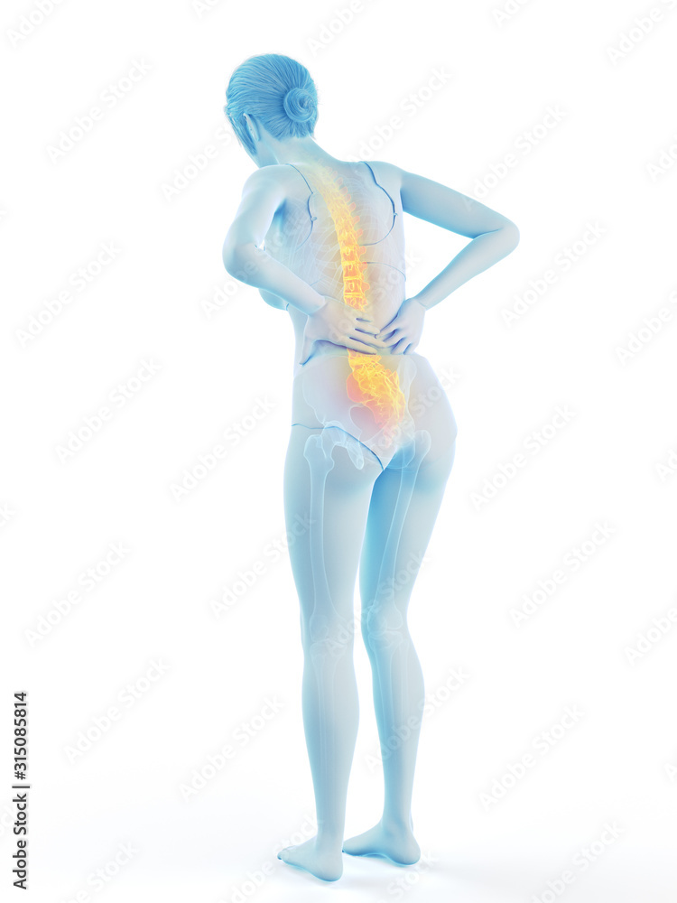 3d rendered medically accurate illustration of a woman having a painful back 3d rendered medically accurate illustration of a woman having a painful back