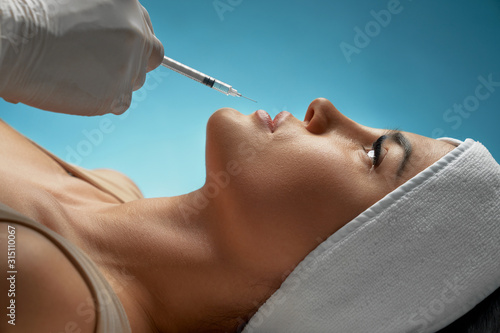 Cosmetic hyaluronic injection in lips.