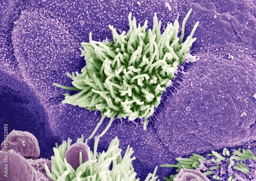 Trachea lining, SEM photo