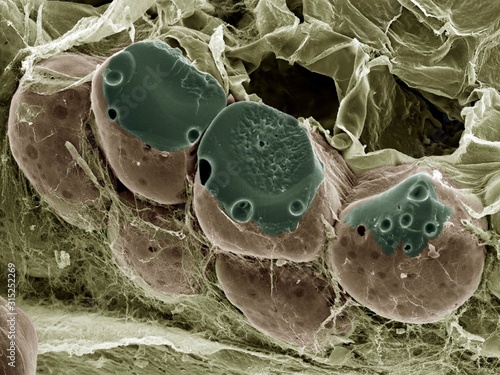 Fat tissue, SEM photo