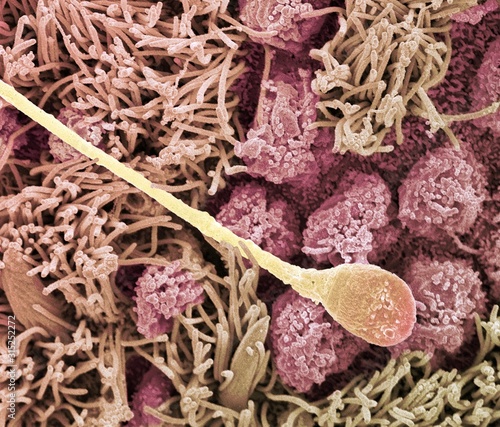 Sperm cell, SEM photo