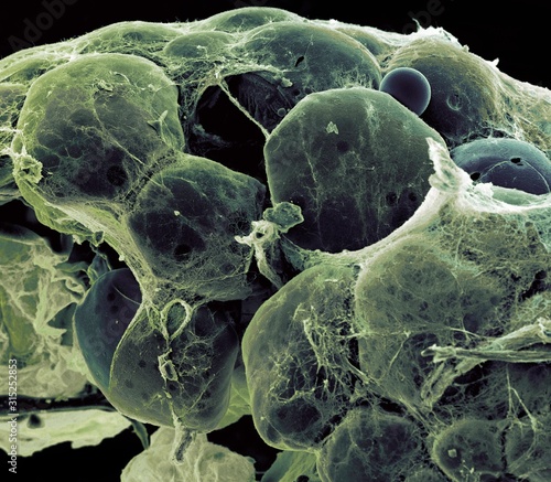 Fat tissue, SEM