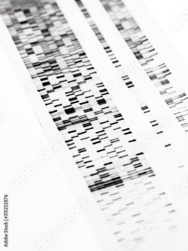 DNA autoradiogram photo