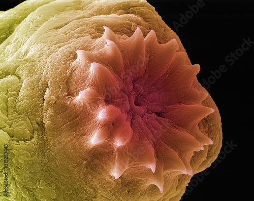 Dog tapeworm head, SEM