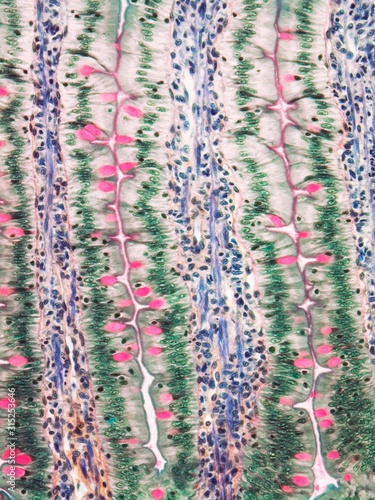 Small intestine, light micrograph