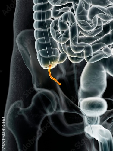 Human appendix, illustration photo