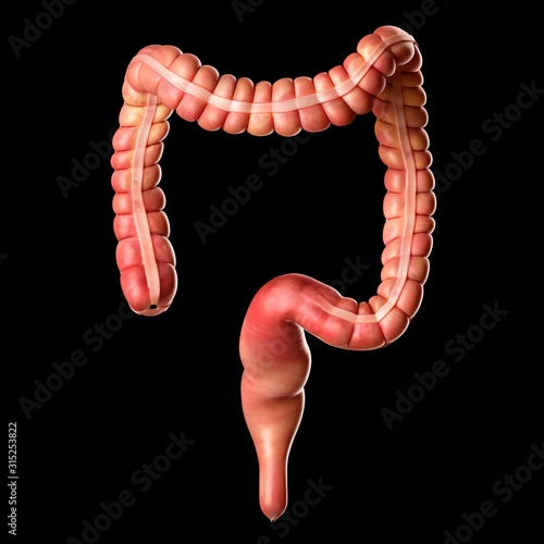 Human large intestine, illustration