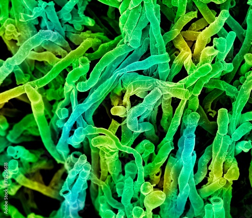 Actinomyces viscosus bacteria, SEM photo