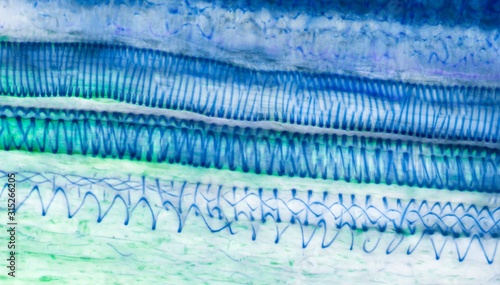 Xylem, LM