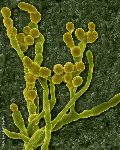 Mould (Cladosporium spp.) hyphae and spores, SEM photo