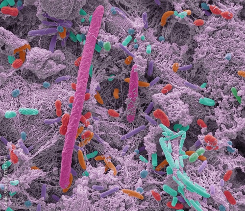 Oral bacteria, SEM photo