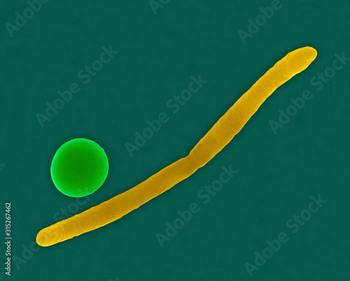 Fusobacterium, Streptococcus, SEM