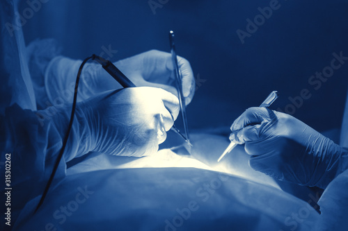 Hands of the surgeon. photo