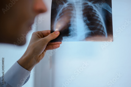 Close up picture of young man doctor who analysis chest x ray © Med Photo Studio