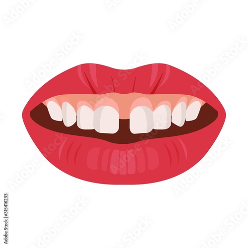 Gap teeth concept. Dental tooth problem and treatment. Dentistry care. Vector