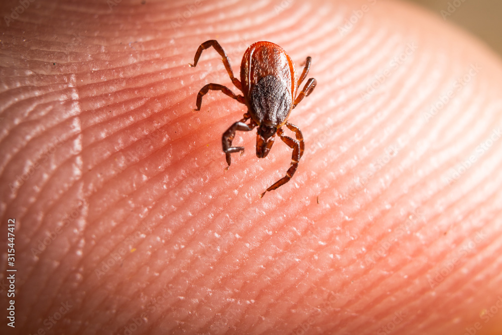 Deer Tick on Skin Deer Tick on Skin