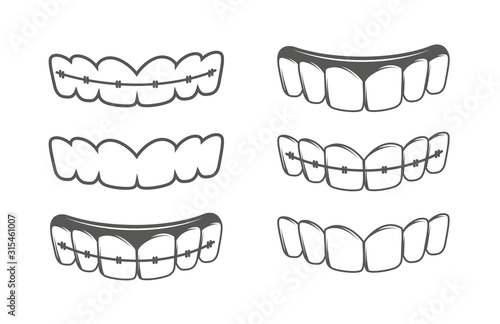 Set of teeth isolated on a white background