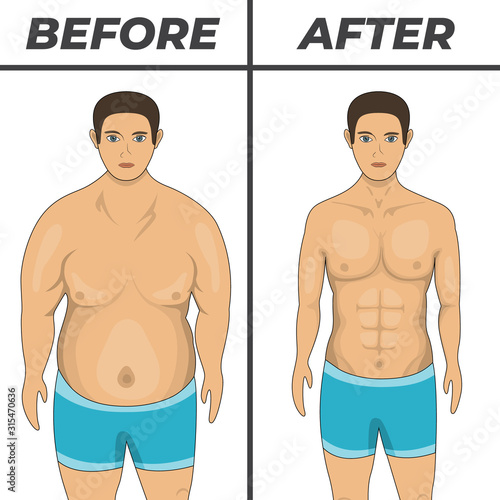 Weigh loss concept design. Overweight problem concept. Isolated vector illustration