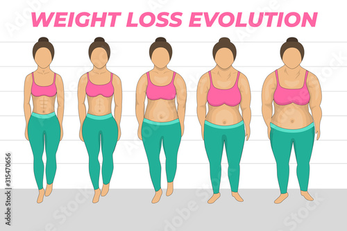Weigh loss concept design. Overweight problem concept. Isolated vector illustration