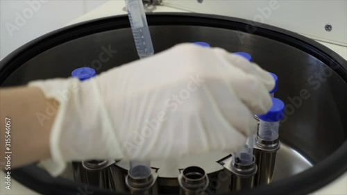 close-up of a doctor's hand loading test samples into the device