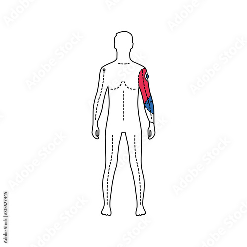 Man with artificial hand color line icon. Person who has a prosthesis instead of a real hand. Pictogram for web page, mobile app, promo. UI UX GUI design element. Editable stroke.