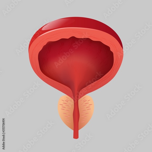 Normal prostate men on a gray background. Male healthy organ, prostate gland. photo