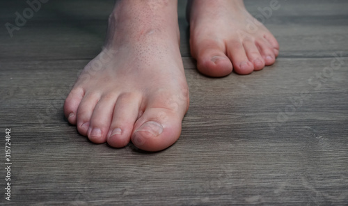 Foot Feet Healthy Feet Barefoot