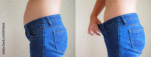 Closeup body of woman with fat belly compare before and after weight loss concept.