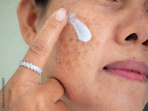 Foto Asian woman are applying cream for facial treatment problem spot melasma pigmentation skincare on her face