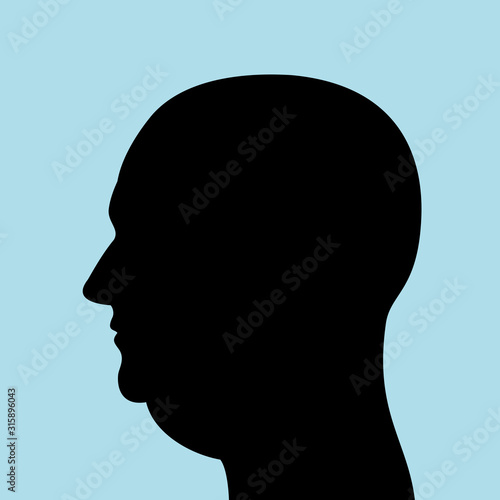 Man with bald head and double chin and submental fat - ugly and unhealthy appearance because of fat, obesity, overweight or illness and disease. Vector illustration. 